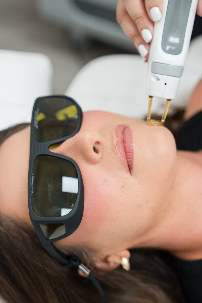 med spa brand photos - photo of laser therapy